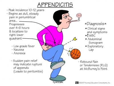 Atypical presentation of Appendicitis - Diagnosis and Management