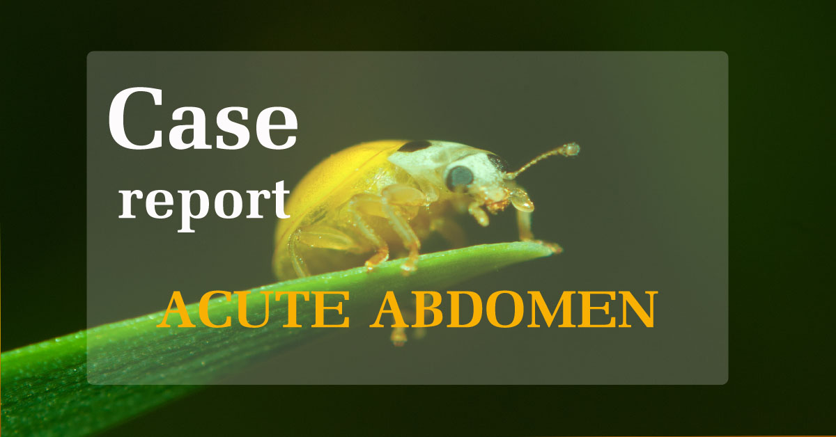 Case 1: Infective endocarditis initial presentation of acute abdomen