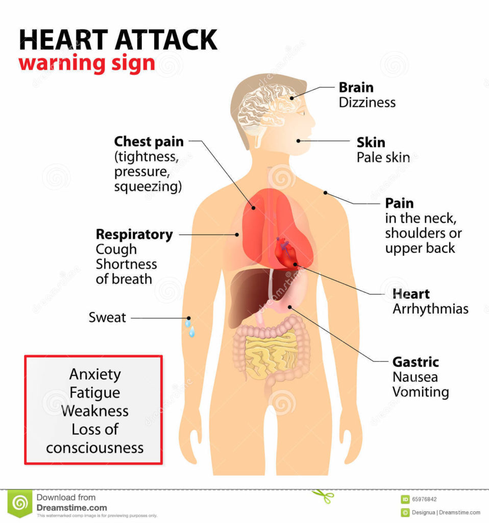 heart-attack-symptoms-signs-human-silhouette-highlighted-internal-organs-warning-sign-65976842