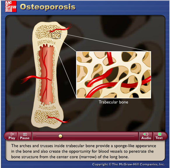 thuật ngữ tiếng anh y khoa osteoporosis