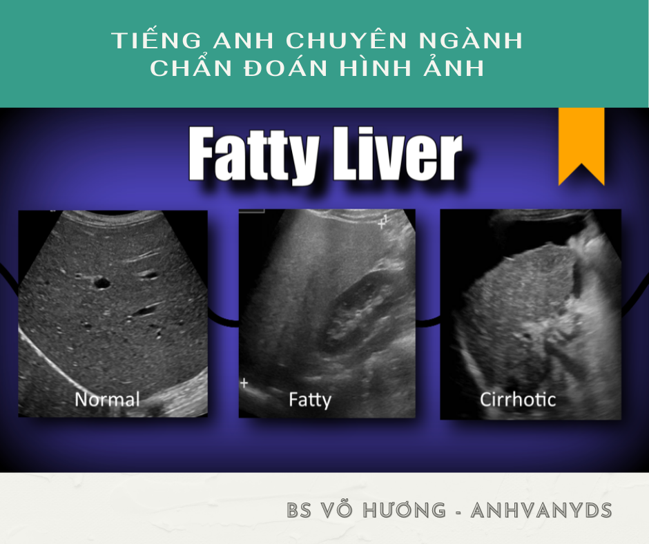 Anhvanyds - Chuẩn đoán hình ảnh gan nhiễm mỡ - fatty liver