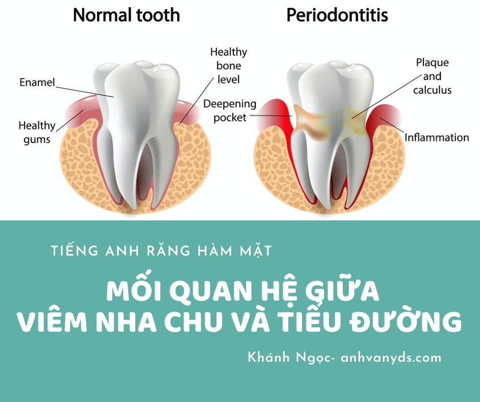thuật ngữ răng hàm mặt - viêm nha chu