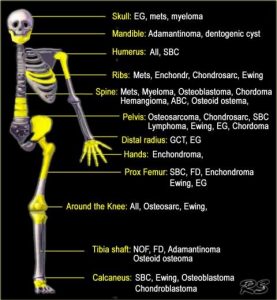 Vị trí trong khung xương (Location within the skeleton)