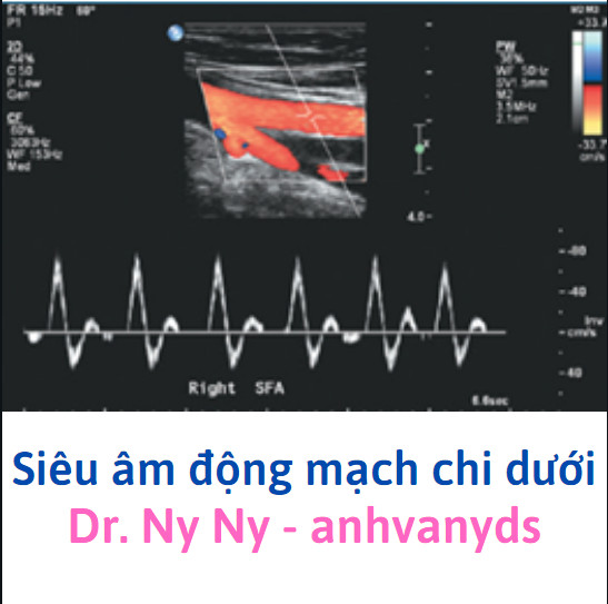 Đánh Giá Động Mạch Chi Dưới Trên Siêu Âm (Ultrasound Assessment Of Lower Extremity Arteries)