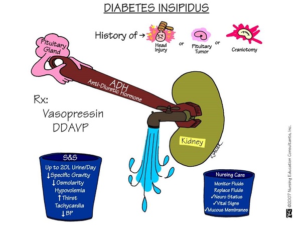 Diabetes insipidus là gì?